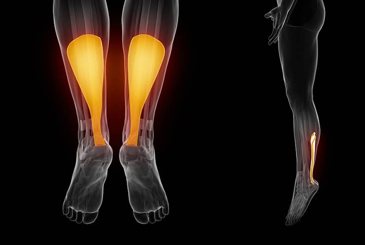 Achilles Tendinopathy